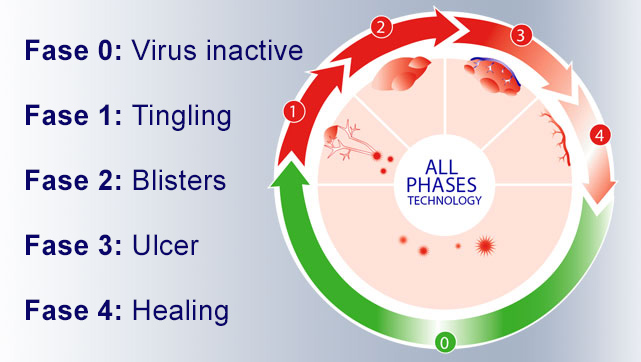 Phases of a cold sore