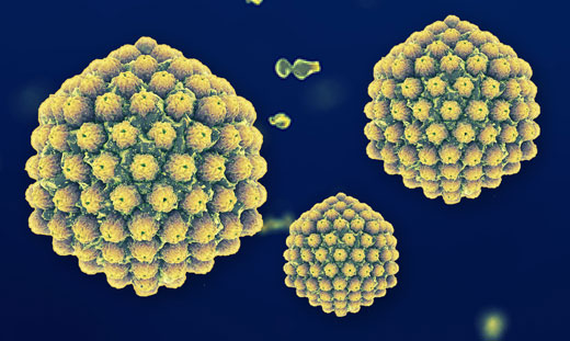 virus